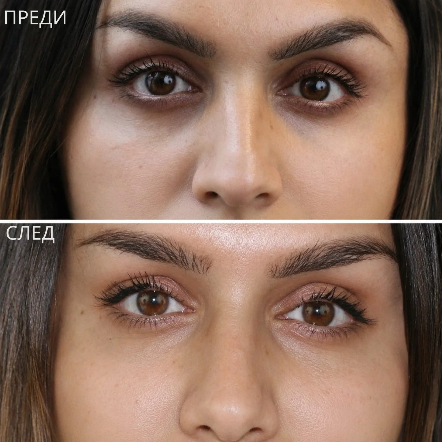2-in-1 Calcium Eye Cream