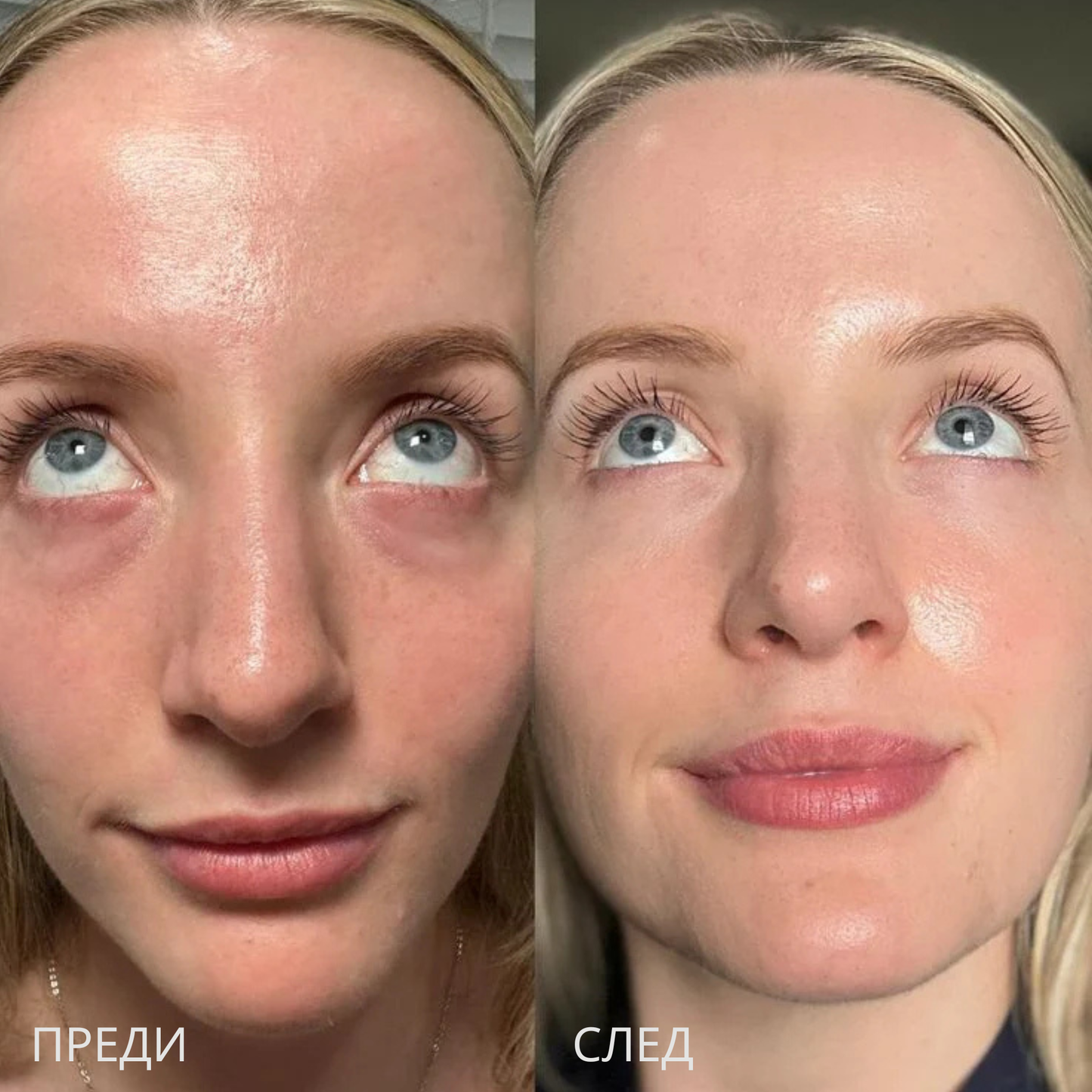 2-in-1 Calcium Eye Cream