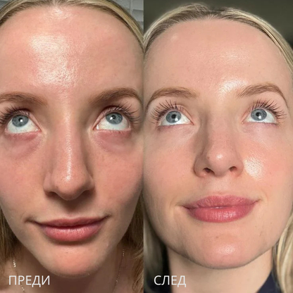 2-in-1 Calcium Eye Cream
